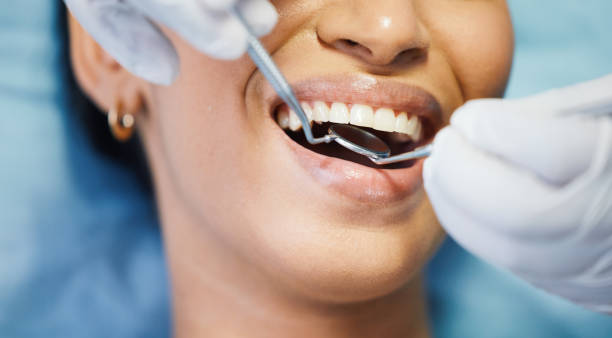 Best Tooth Pain Emergency Relief  in Ocilla, GA